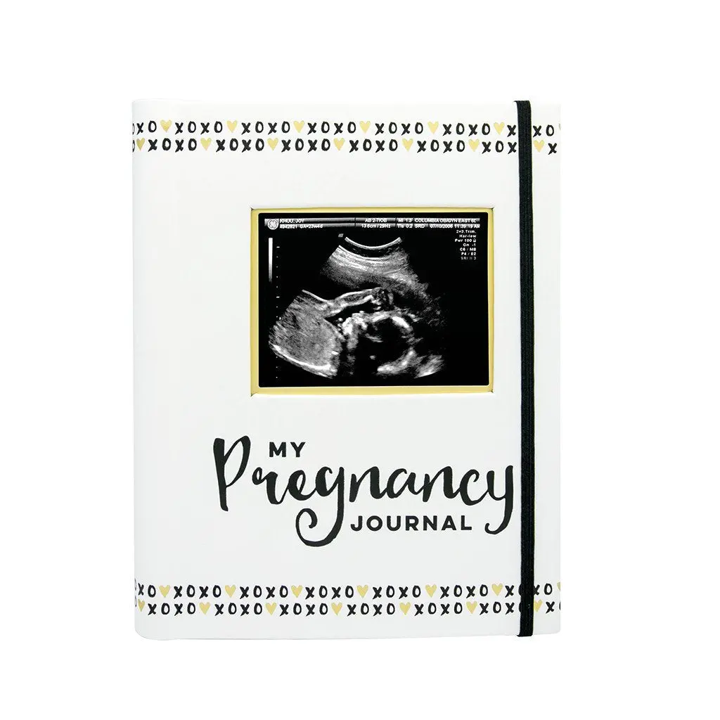 Pregnancy Journal - Black & White 1